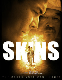 Skins