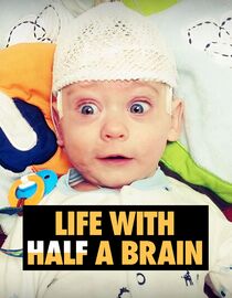 Life with Half a Brain