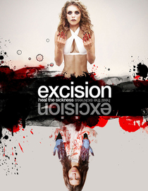 Excision