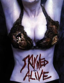 Skinned Alive
