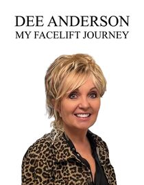 Dee Anderson: My Facelift Journey