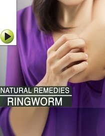 Skin Care : Ringworm - Natural Ayurvedic Home Remedies